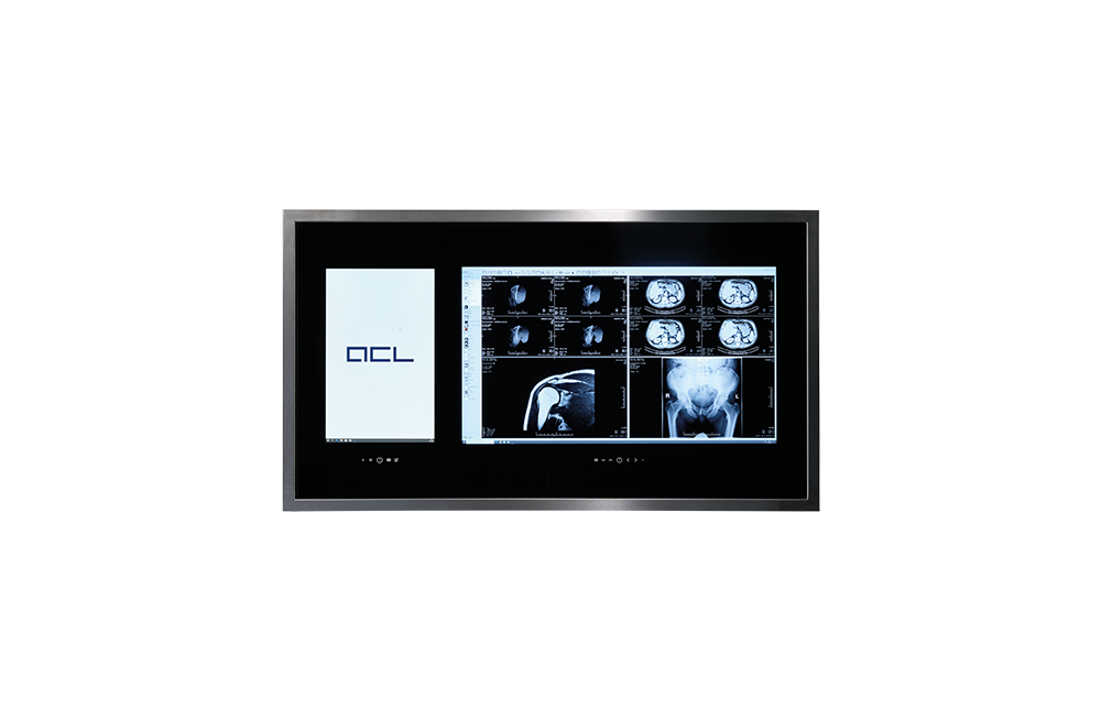ACL Console